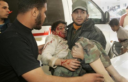 wounded-boy An Israeli strike has killed at least 40 people who had taken refuge inside a UN school in the Gaza Strip Picture: BLOOMBERG
